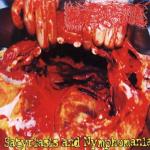 Paracoccidioidomicosisproctitissarcomucosis: "Satyrlasis and Nymphomania" – 2002