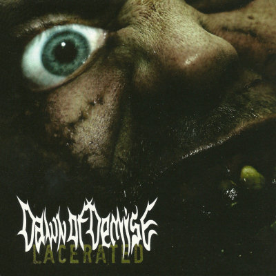 Dawn Of Demise: "Lacerated" – 2008